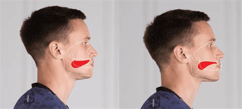 how to mewing.